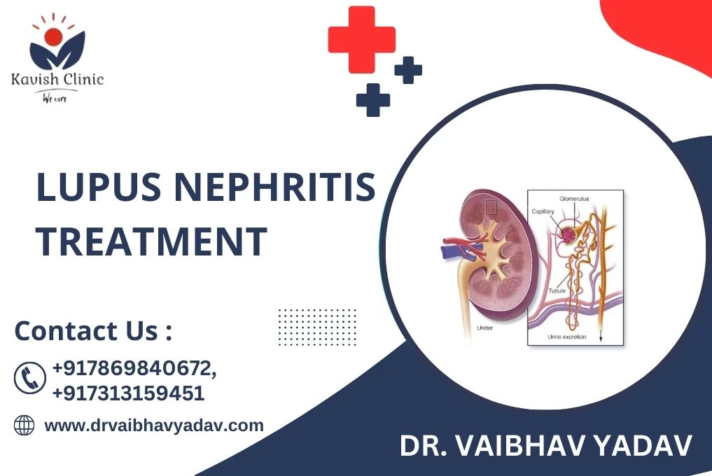 Lupus nephritis Treatment Specialist In Indore