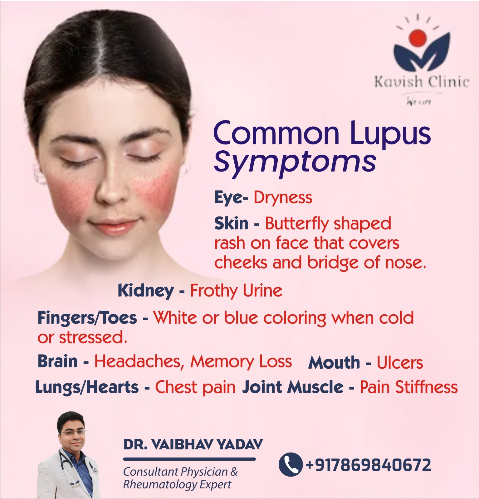 Best Lupus Nephritis Specialist in Indore