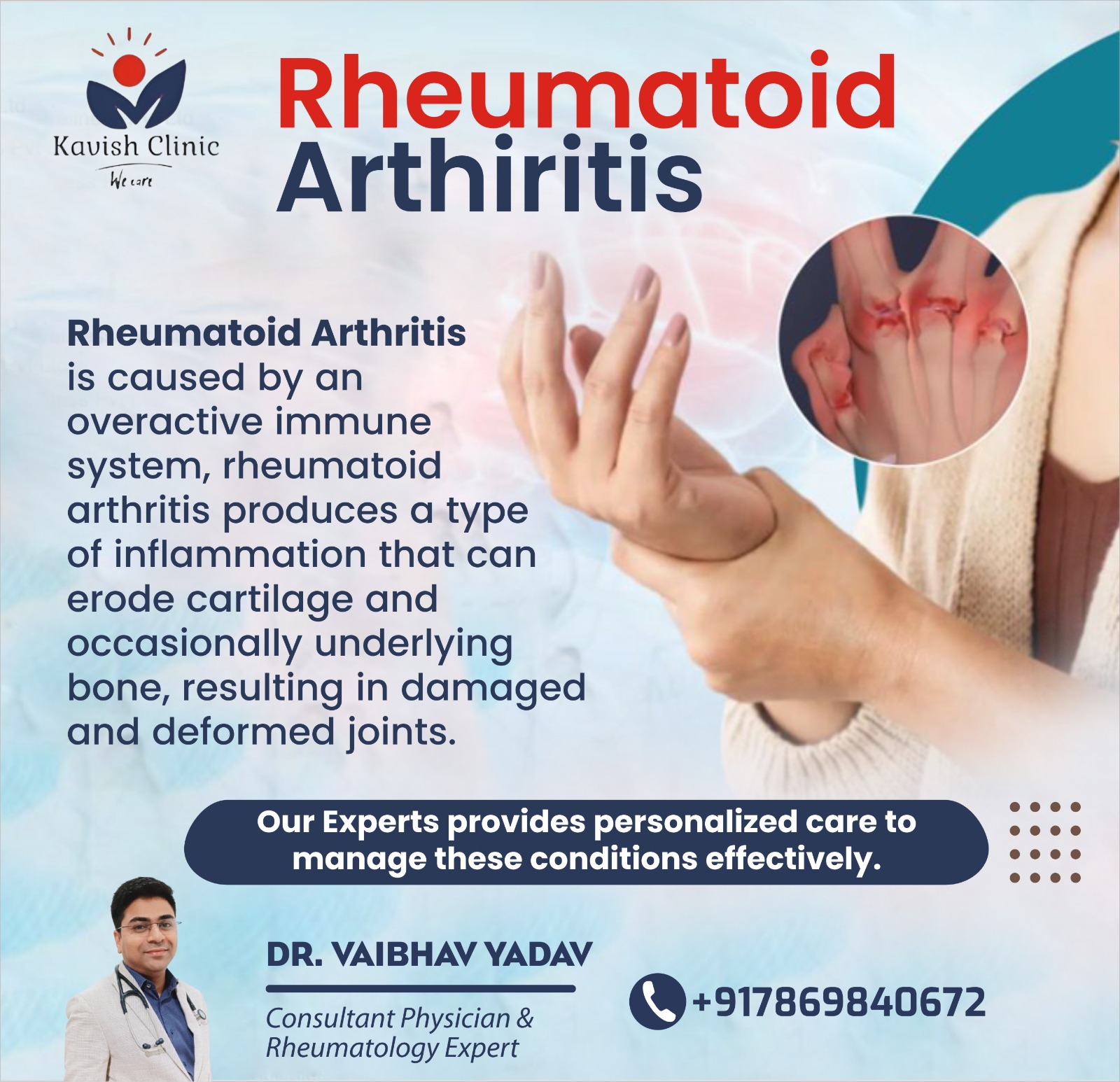 Best Rhuemotoid Arthritis Specialist in Indore