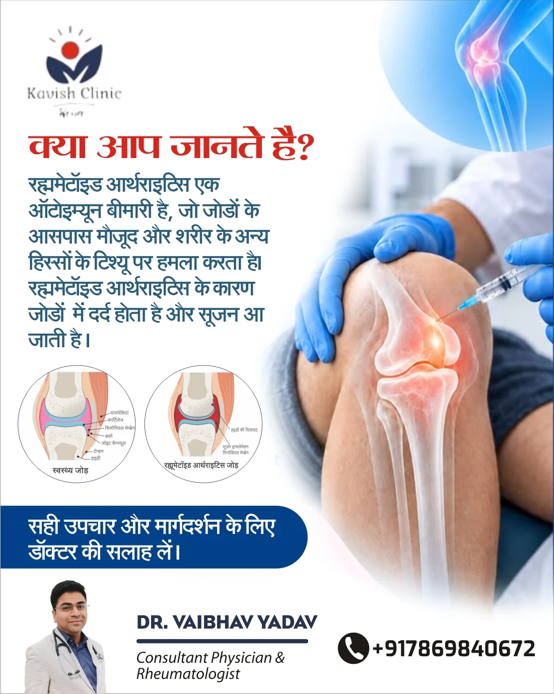Rheumatoid Arthritis Treatment in Indore: Complete Information on Symptoms, Diagnosis, and Care