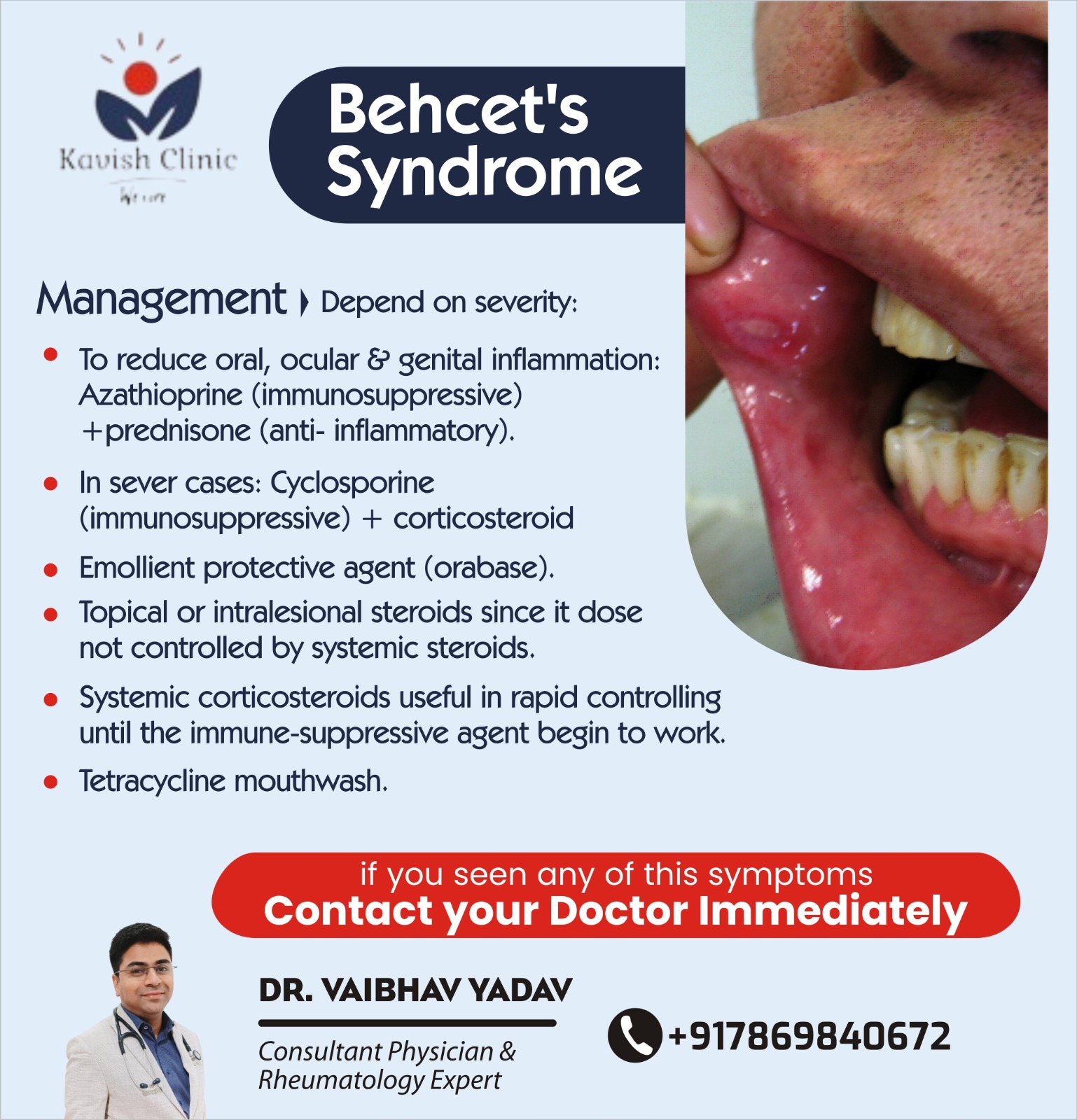 Best Doctor for Behcets Disease Treatment In Indore