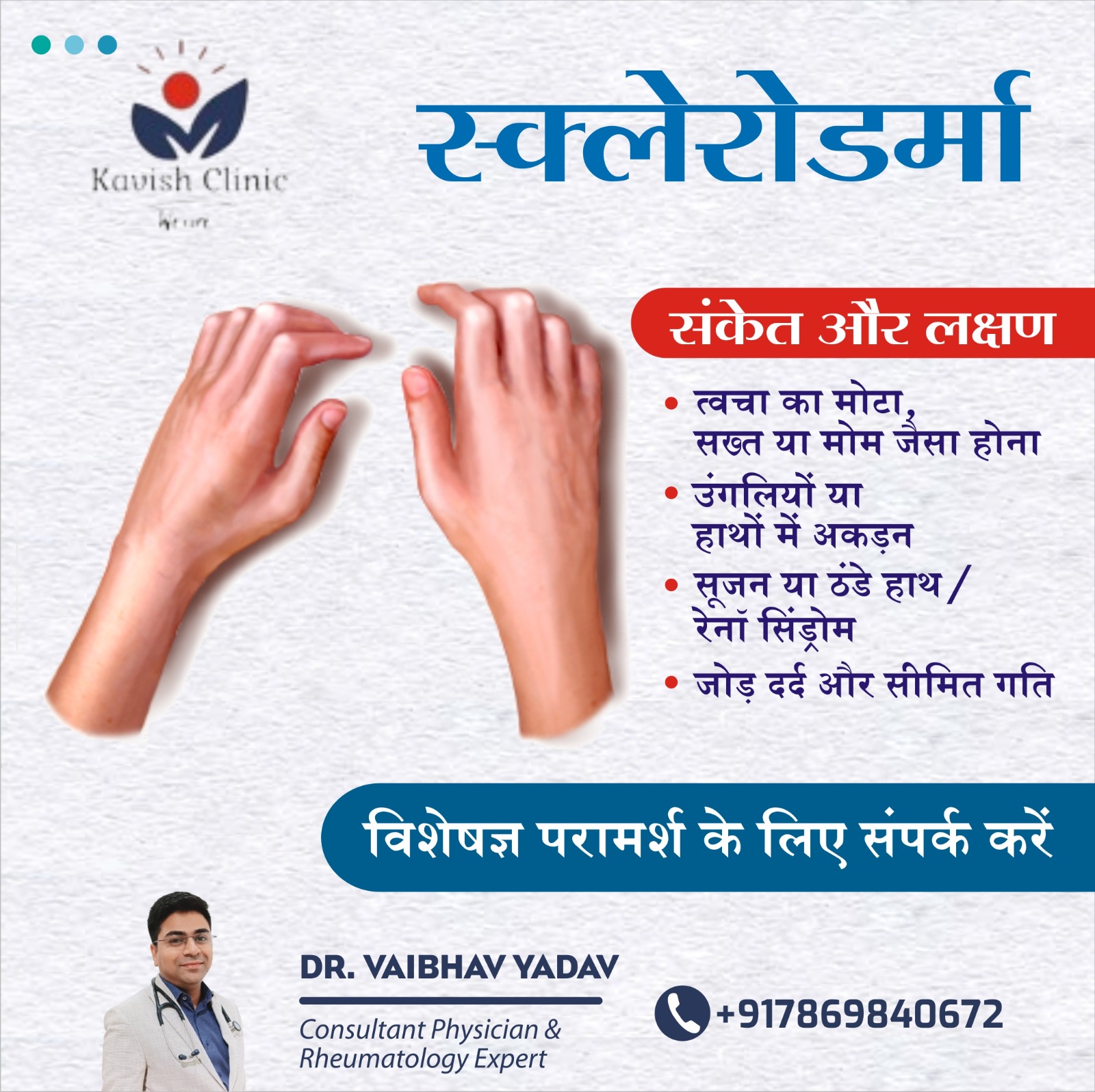 Scleroderma Treatment Specialist In Indore