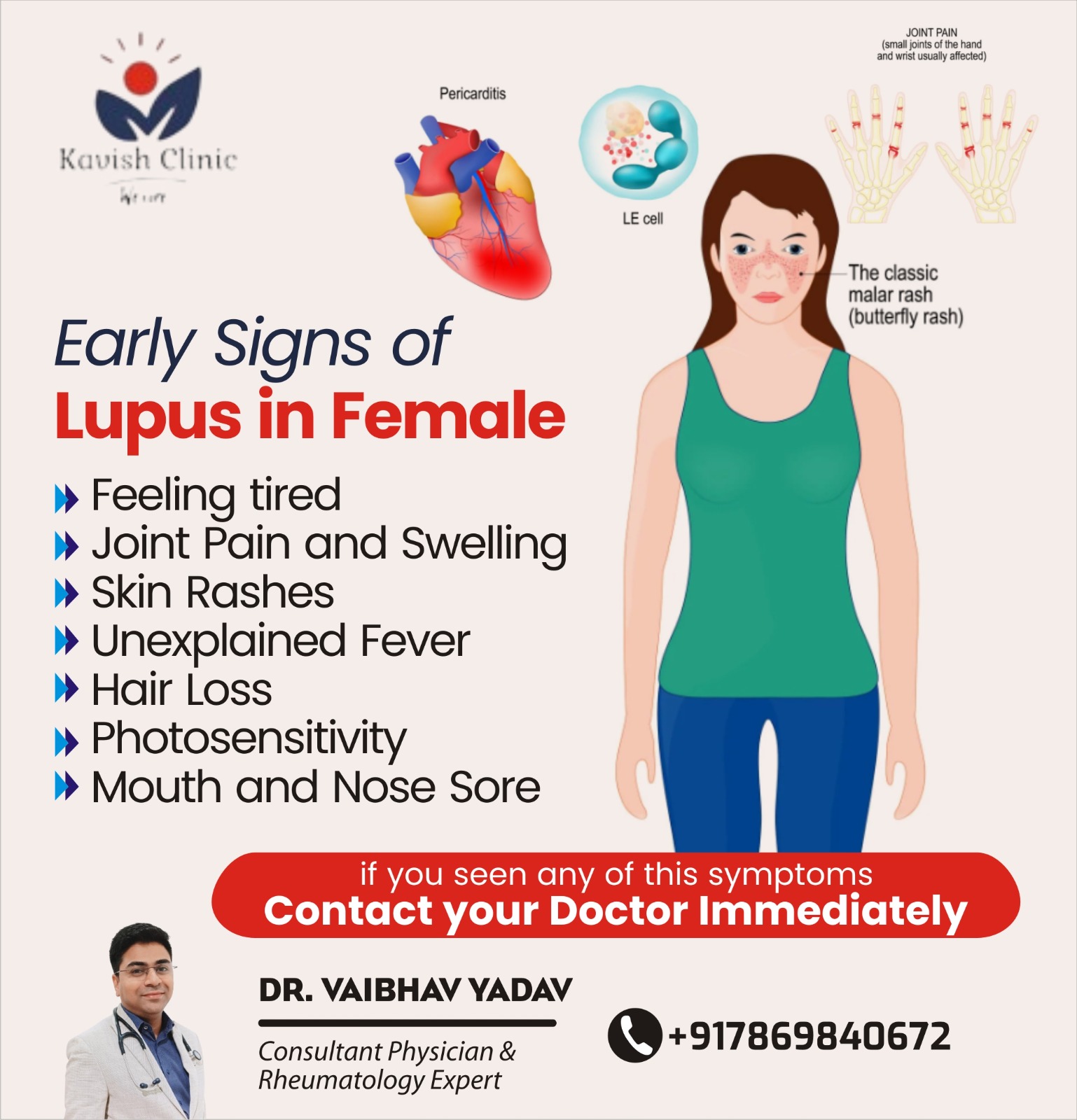 Best Doctor for Lupus Treatment in Indore 