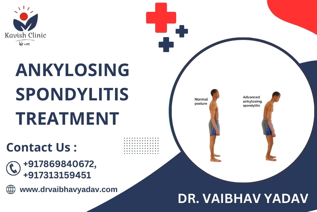 Ankylosing Spondylitis Treatment causes and factors