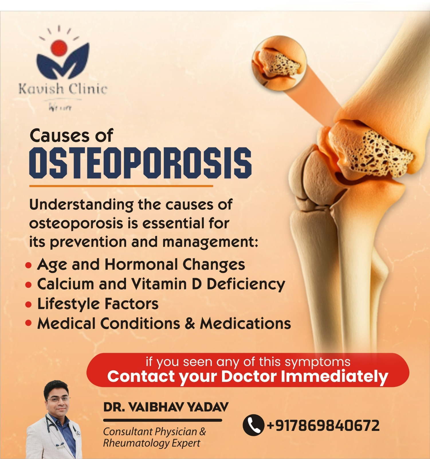 Osteoporosis Treatment Specialist In Indore Symptoms and Treatment