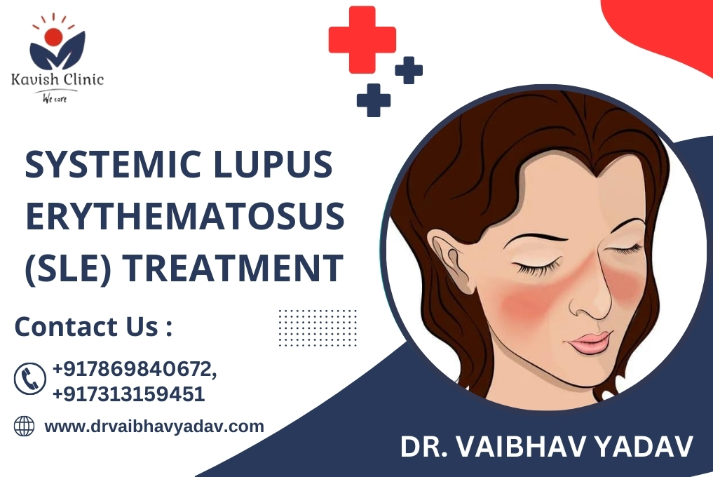 Best Doctor for Lupus Nephritis in Indore